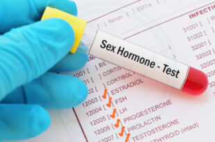 آزمایش خون و لیست هورمون‌ های جنسی