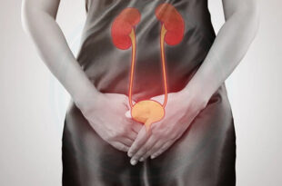 خانمی که با دستش واژنش رو پوشونده/سوزش ادرار بعد از رابطه جنسی